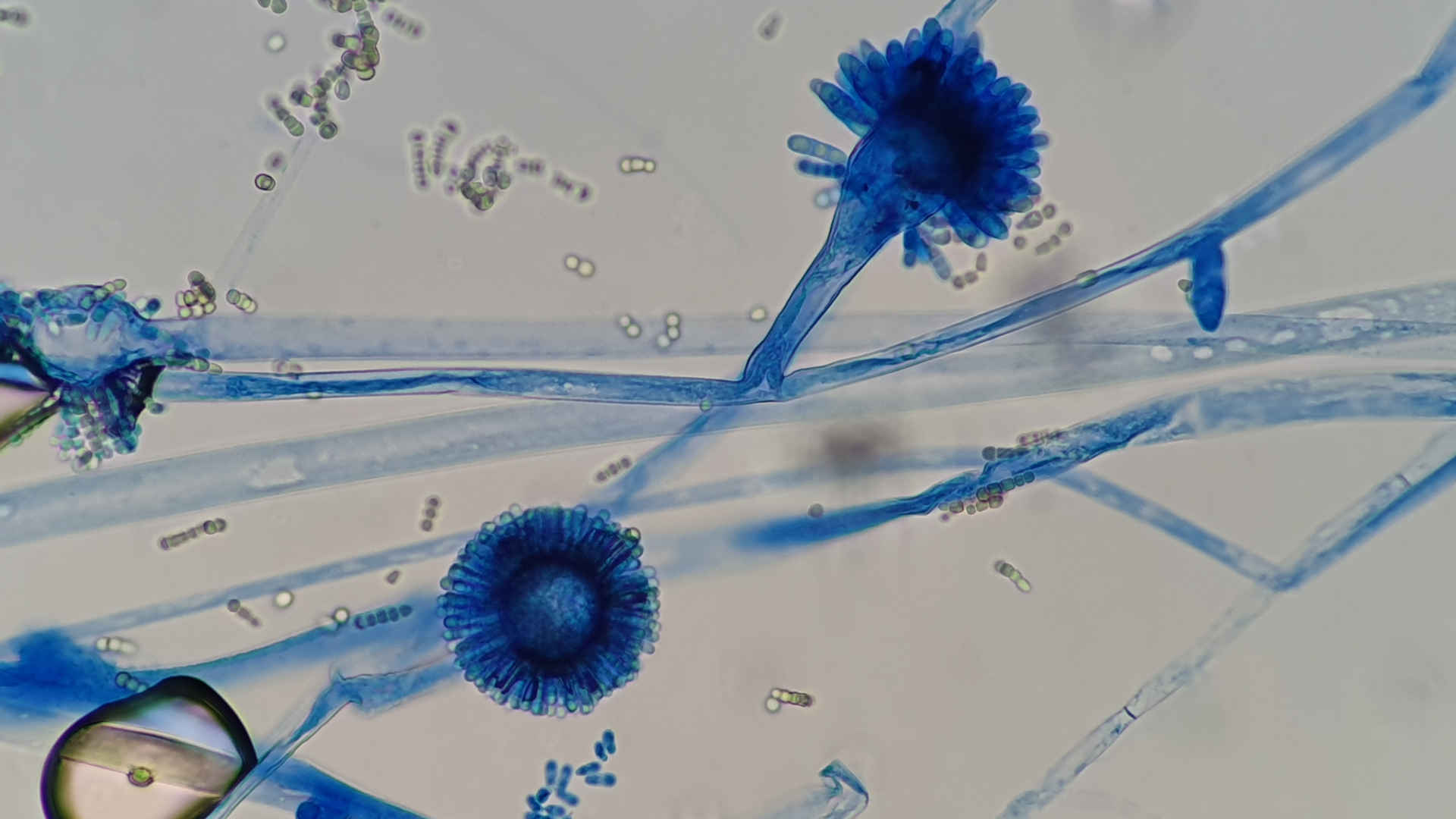 Aspergillus