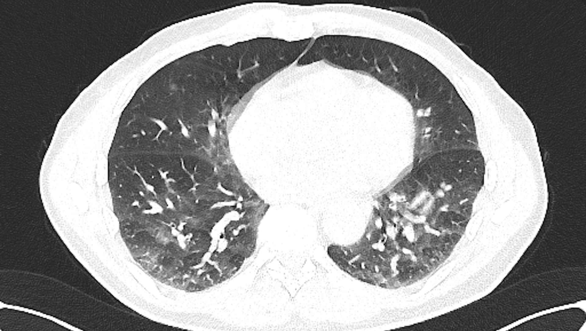 Home ns1 criticalcarereviews 